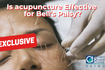 Is Acupuncture Effective for Bell’s Palsy?