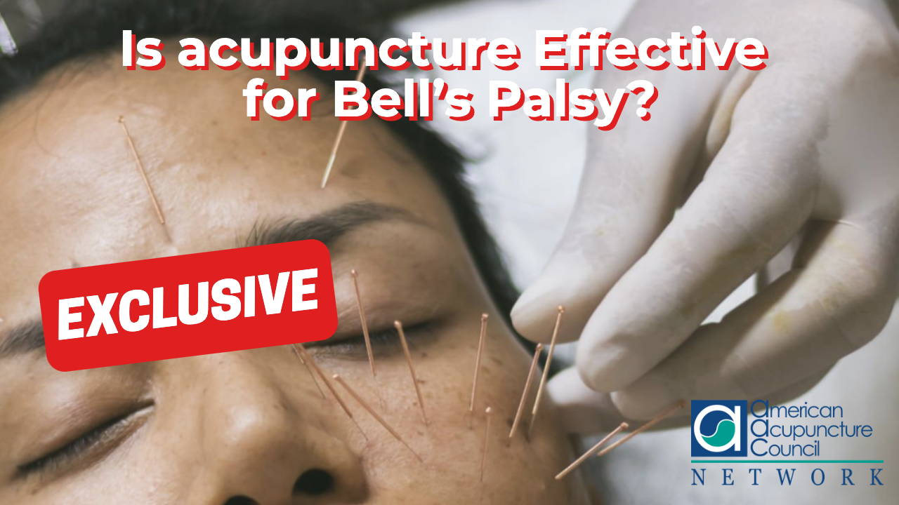 Is Acupuncture Effective for Bell’s Palsy?