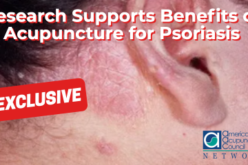 Psoriasis