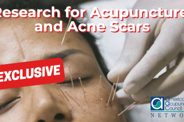 Research for Acupuncture and Acne Scars