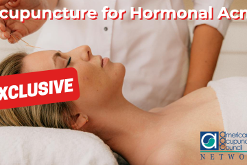 Acupuncture for Hormonal Acne